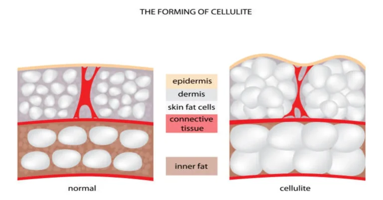 Cellulogia