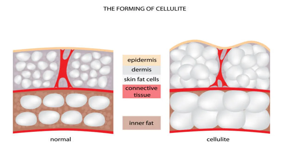 Cellulogia