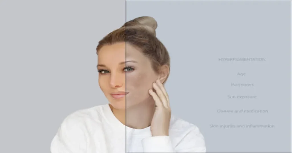 SkinPres T