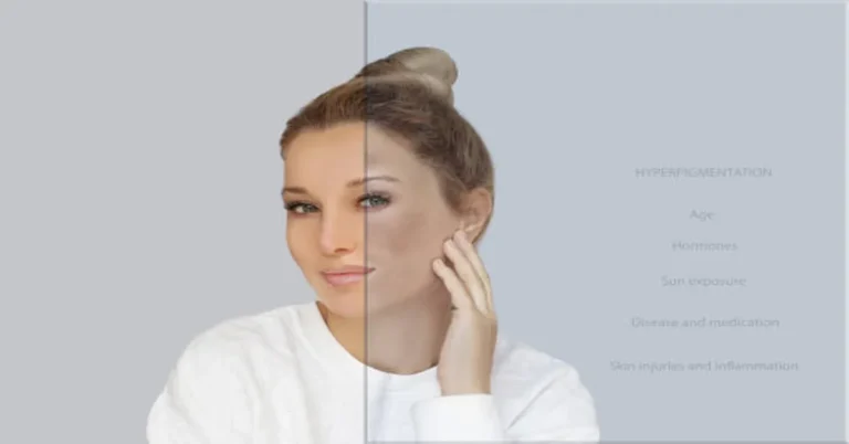 SkinPres T